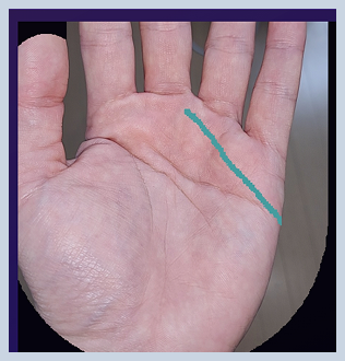 기존 앱 손금분석